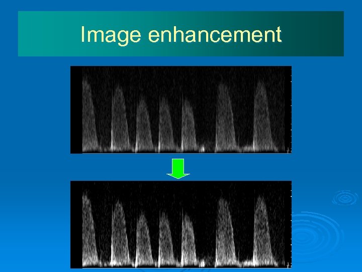 Image enhancement 