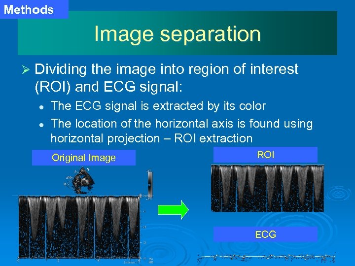 Methods Image separation Ø Dividing the image into region of interest (ROI) and ECG