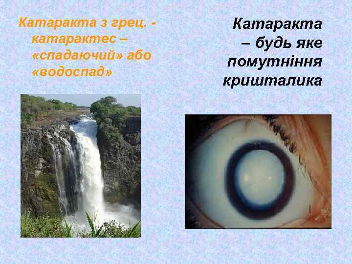 Катаракта з грец. катарактес – «спадаючий» або «водоспад» Катаракта – будь яке помутніння кришталика