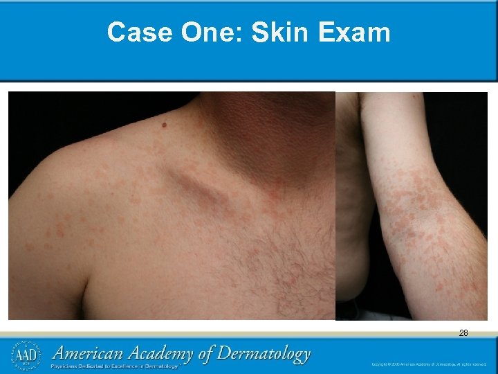 Case One: Skin Exam 28 28 