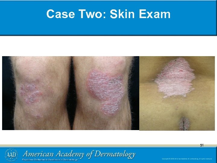 Case Two: Skin Exam 51 51 