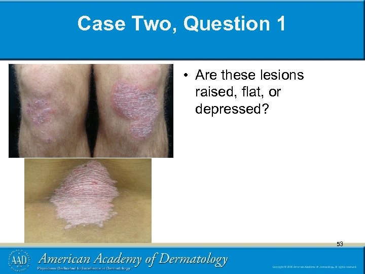 Case Two, Question 1 • Are these lesions raised, flat, or depressed? 53 53