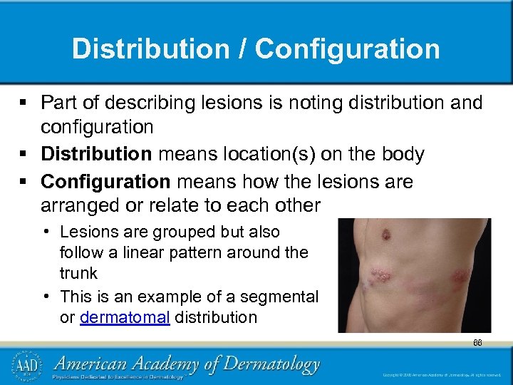 Distribution / Configuration § Part of describing lesions is noting distribution and configuration §