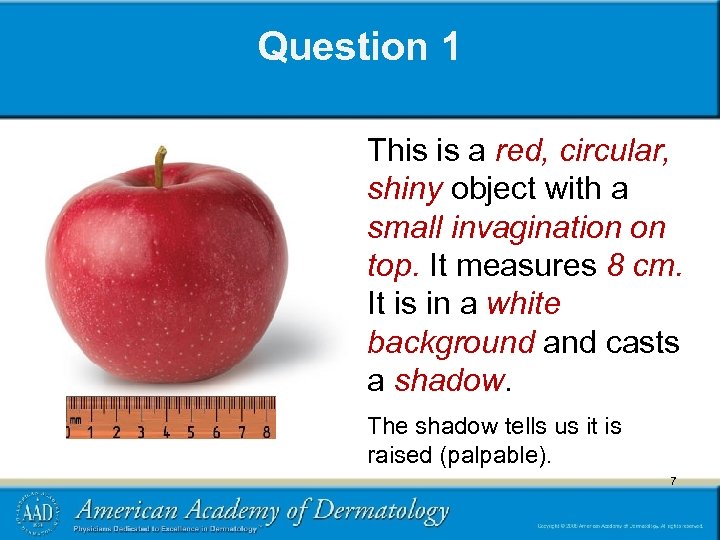 Question 1 This is a red, circular, shiny object with a small invagination on