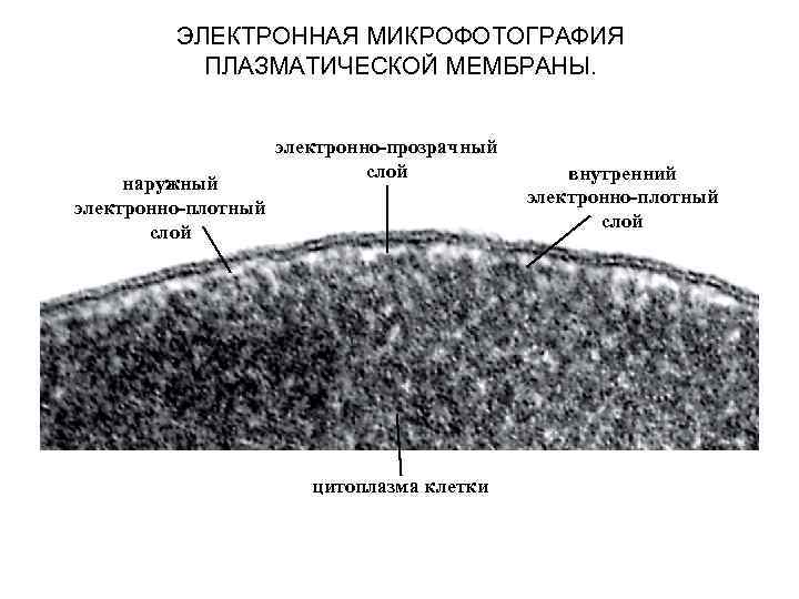 ЭЛЕКТРОННАЯ МИКРОФОТОГРАФИЯ ПЛАЗМАТИЧЕСКОЙ МЕМБРАНЫ. наружный электронно-плотный слой электронно-прозрачный слой цитоплазма клетки внутренний электронно-плотный слой