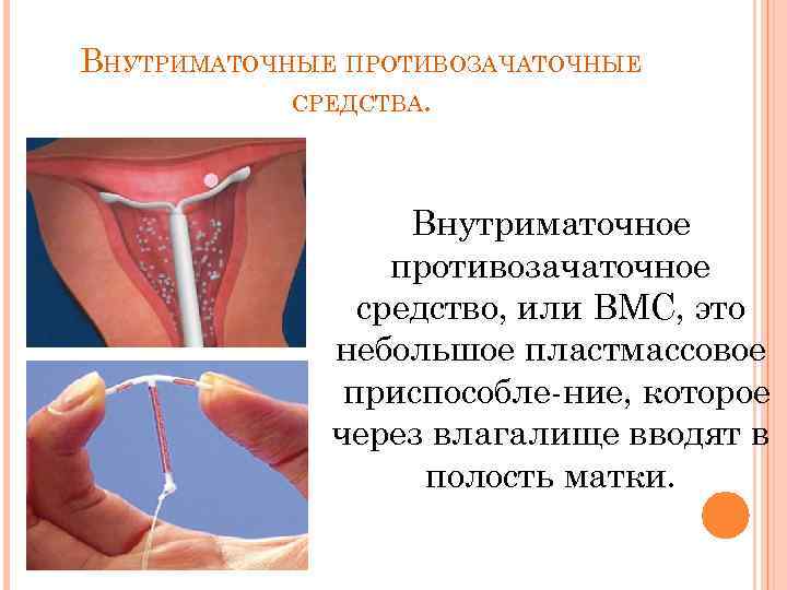 Внутриматочная патология презентация