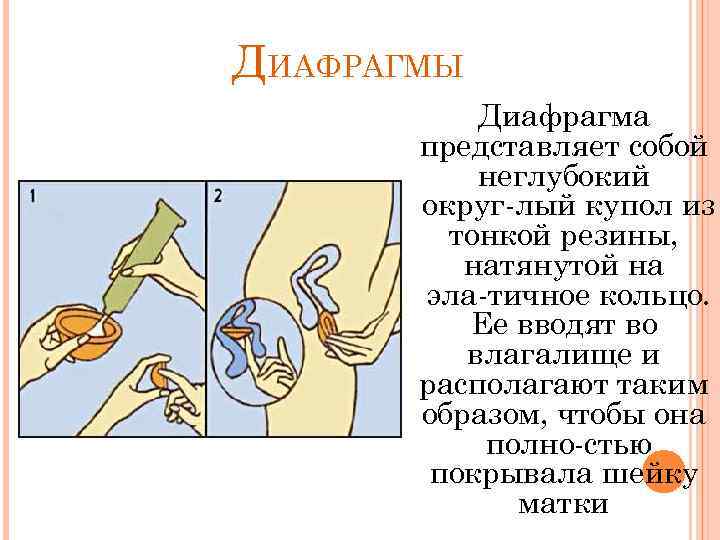 ДИАФРАГМЫ Диафрагма предcтавляет cобой неглубокий округ лый купол из тонкой резины, натянутой на эла