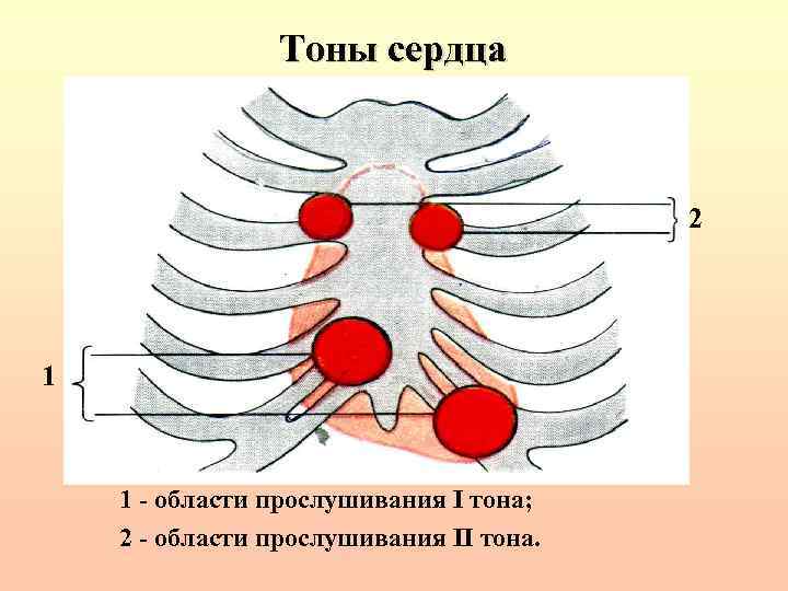 Тоны сердца картинки