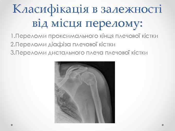 Класифікація в залежності від місця перелому: 1. Переломи проксимального кінця плечової кістки 2. Переломи