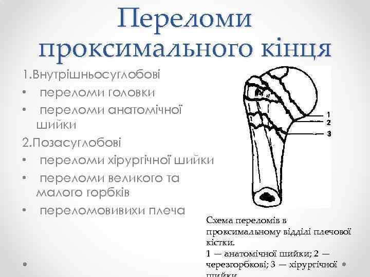 Переломи проксимального кінця 1. Внутрішньосуглобові • переломи головки • переломи анатомічної шийки 2. Позасуглобові