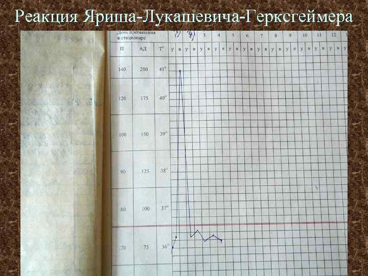 Реакция Яриша-Лукашевича-Герксгеймера 