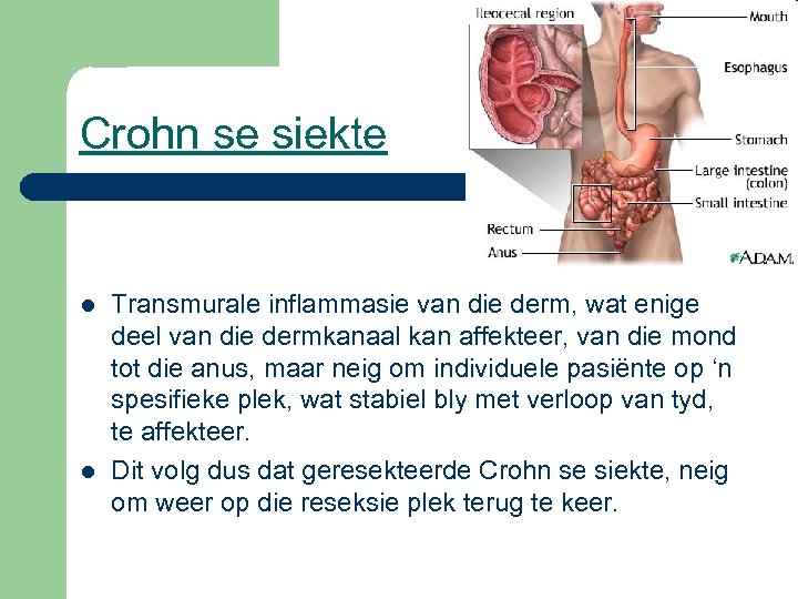 Crohn se siekte l l Transmurale inflammasie van die derm, wat enige deel van