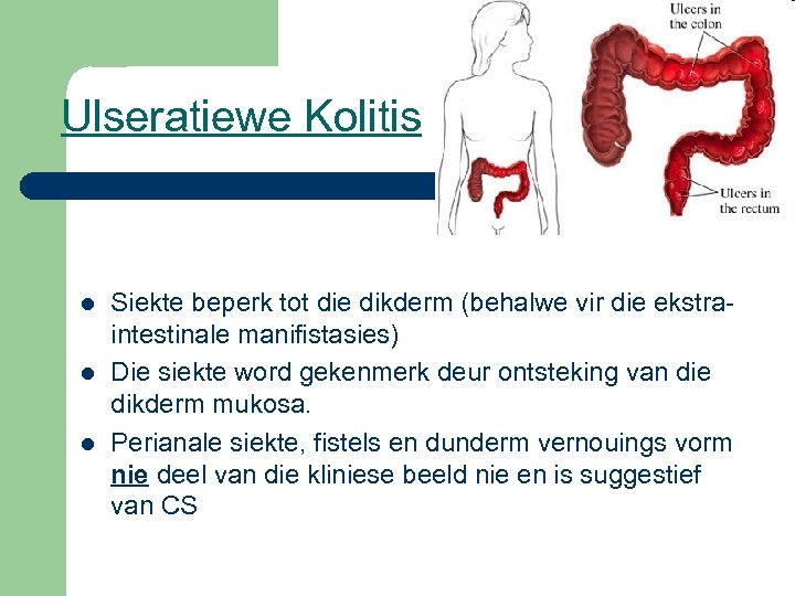 Ulseratiewe Kolitis l l l Siekte beperk tot die dikderm (behalwe vir die ekstraintestinale