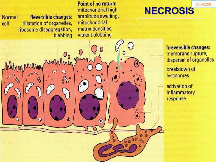 NECROSIS 