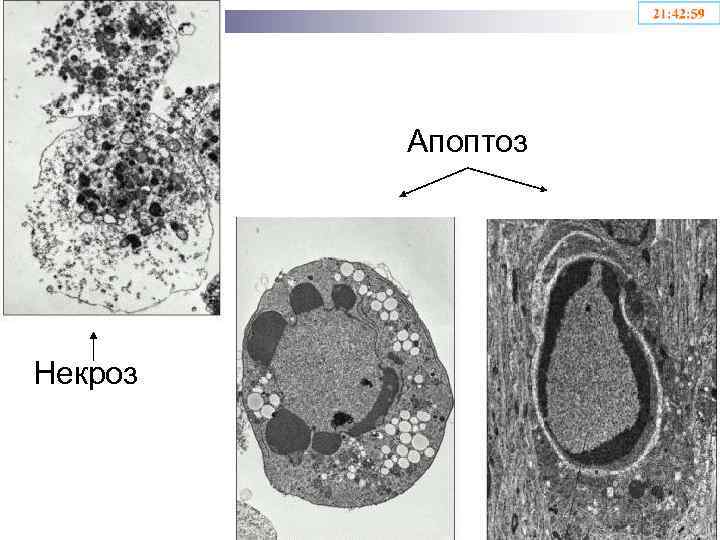 Апоптоз Некроз 