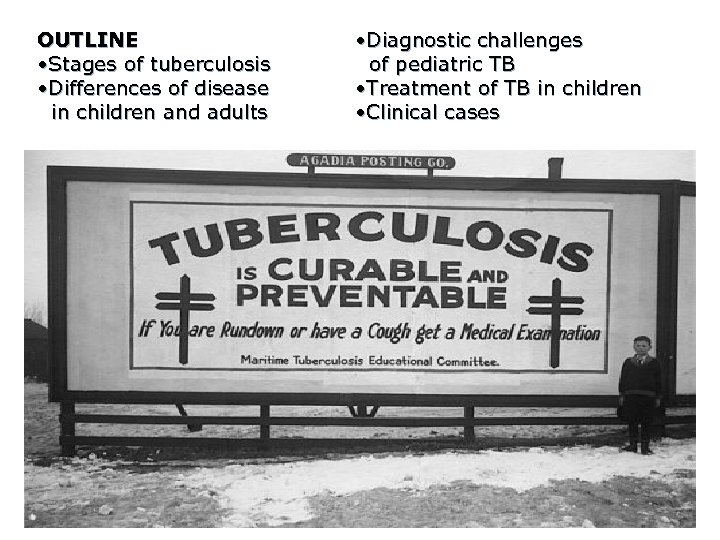 OUTLINE • Stages of tuberculosis • Differences of disease in children and adults •