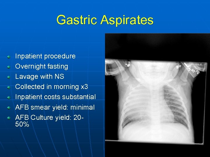 Gastric Aspirates Inpatient procedure Overnight fasting Lavage with NS Collected in morning x 3