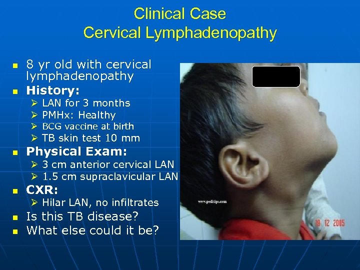 Clinical Case Cervical Lymphadenopathy n n 8 yr old with cervical lymphadenopathy History: Ø