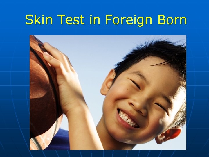 Skin Test in Foreign Born 