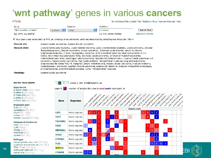 ‘wnt pathway’ genes in various cancers 62 Array. Express 