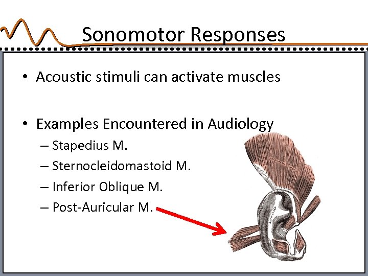 Sonomotor Responses • Acoustic stimuli can activate muscles • Examples Encountered in Audiology –