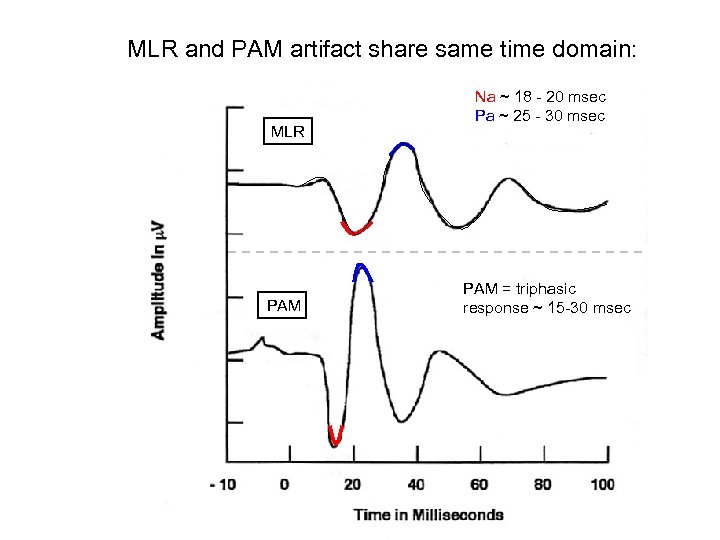 MLR and PAM artifact share same time domain: MLR PAM Na ~ 18 -