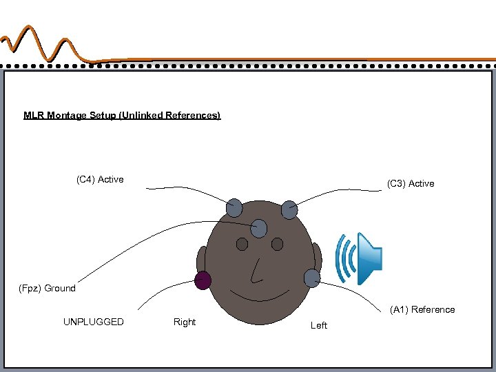 MLR Montage Setup (Unlinked References) (C 4) Active (C 3) Active (Fpz) Ground (A