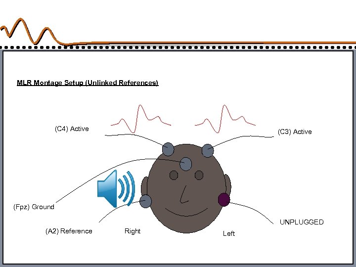 MLR Montage Setup (Unlinked References) (C 4) Active (C 3) Active (Fpz) Ground UNPLUGGED