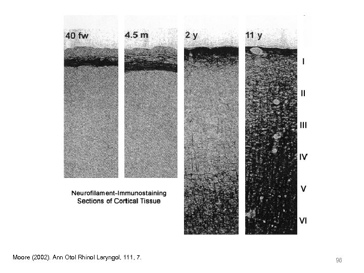 Moore (2002). Ann Otol Rhinol Laryngol, 111, 7. 96 