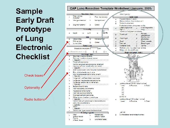 Sample Early Draft Prototype of Lung Electronic Checklist Check boxes Optionality Radio buttons 