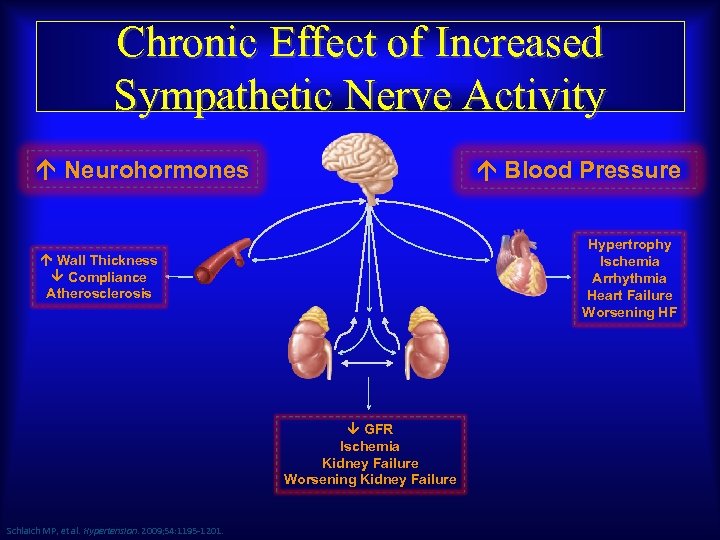 Chronic Effect of Increased Sympathetic Nerve Activity Neurohormones Blood Pressure Hypertrophy Ischemia Arrhythmia Heart