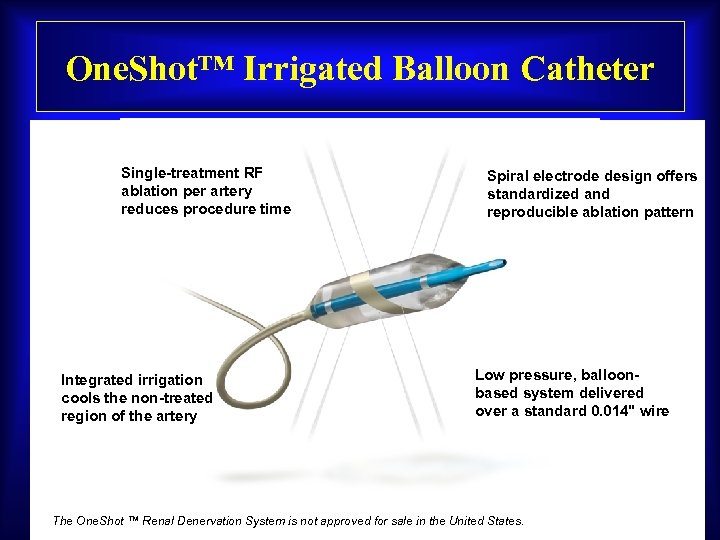 One. Shot™ Irrigated Balloon Catheter Single-treatment RF ablation per artery reduces procedure time Integrated