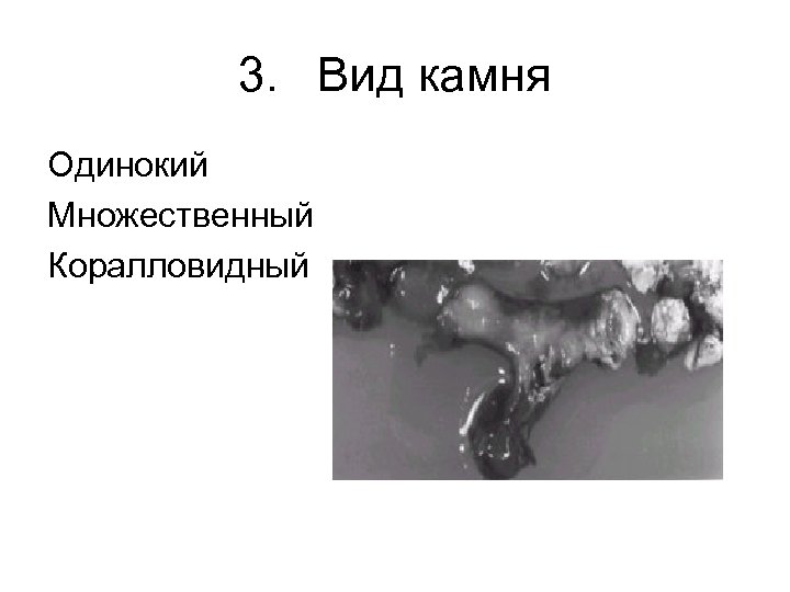 3. Вид камня Одинокий Множественный Коралловидный 