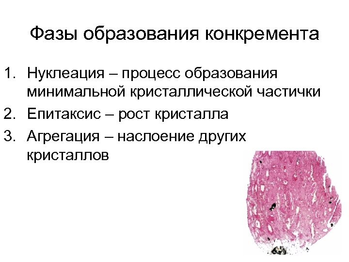 Фазы образования конкремента 1. Нуклеация – процесс образования минимальной кристаллической частички 2. Епитаксис –