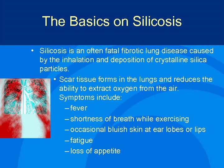 The Basics on Silicosis • Silicosis is an often fatal fibrotic lung disease caused