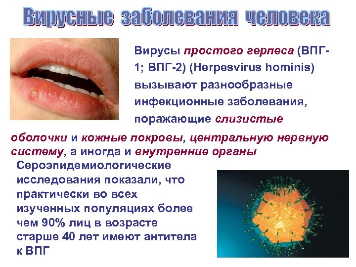 Вирусы простого герпеса (ВПГ 1; ВПГ-2) (Herpesvirus hominis) вызывают разнообразные инфекционные заболевания, поражающие слизистые