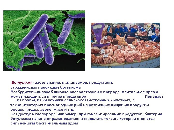 Ботулизм - заболевание, вызываемое, продуктами, зараженными палочками ботулизма Возбудитель-анаэроб широко распространен в природе, длительное