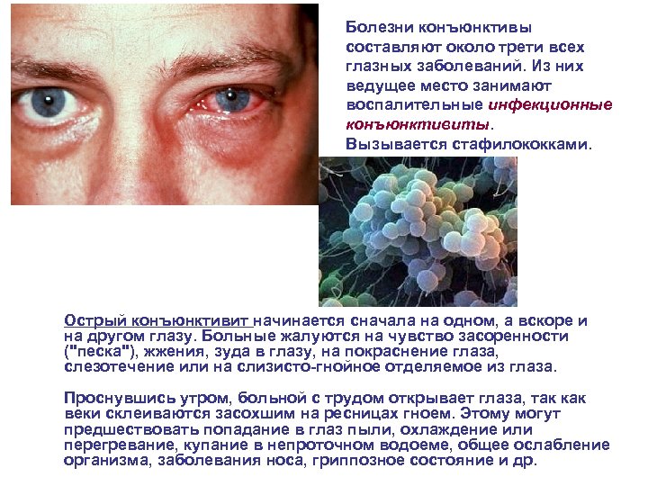 Болезни конъюнктивы составляют около трети всех глазных заболеваний. Из них ведущее место занимают воспалительные