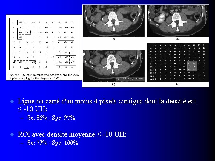 l Ligne ou carré d'au moins 4 pixels contigus dont la densité est ≤
