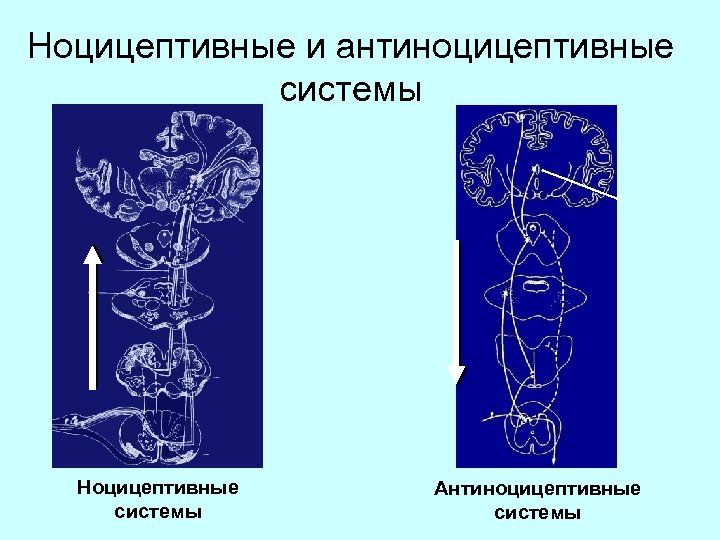 Ноцицептивная система. Ноцицептивная система и антиноцицептивная системы. Антиноцицептивная система уровни. Механизмы активации антиноцицептивной системы. Схема взаимодействия ноцицептивной и антиноцицептивной систем.