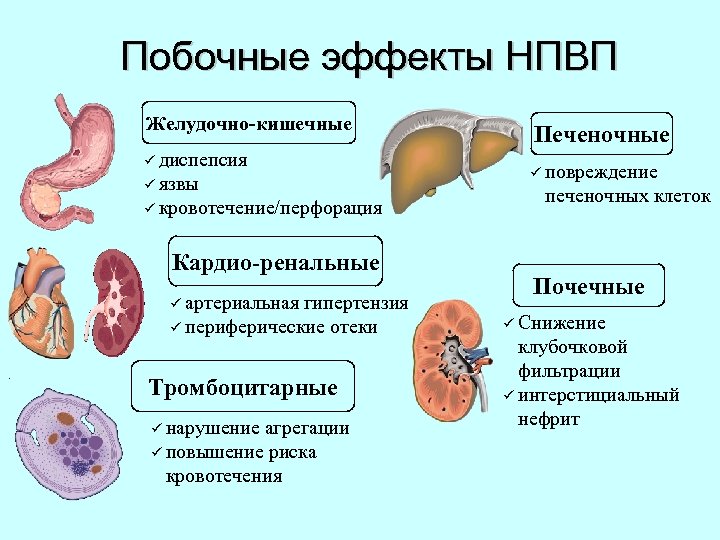 Побочные эффекты НПВП Желудочно-кишечные ü диспепсия ü язвы ü кровотечение/перфорация Кардио-ренальные ü артериальная гипертензия