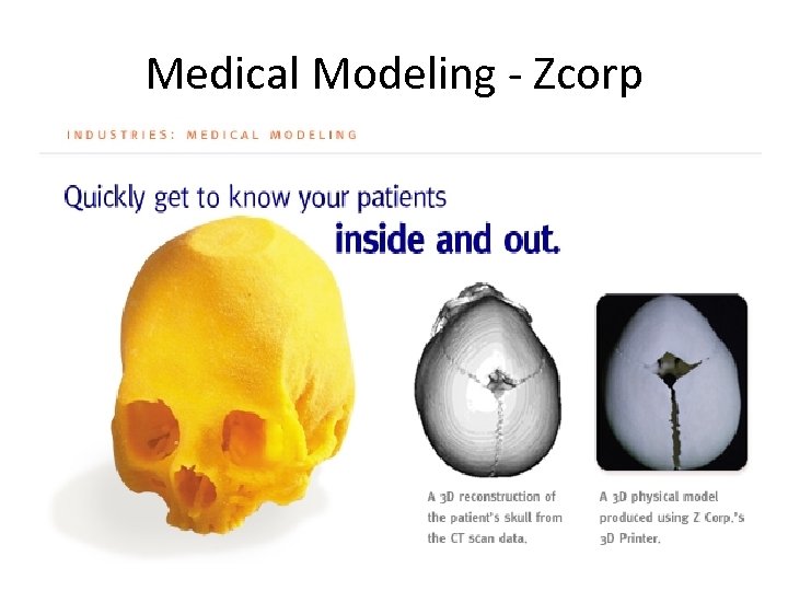 Medical Modeling - Zcorp 