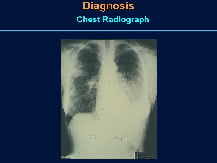 Diagnosis Chest Radiograph 