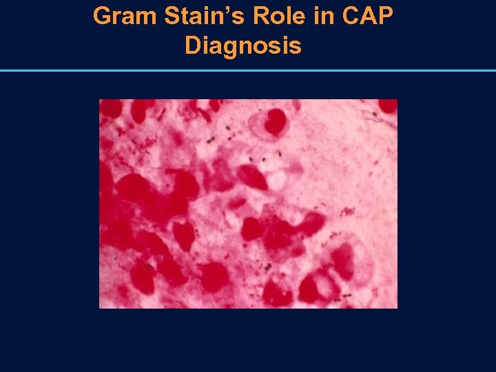 Gram Stain’s Role in CAP Diagnosis 