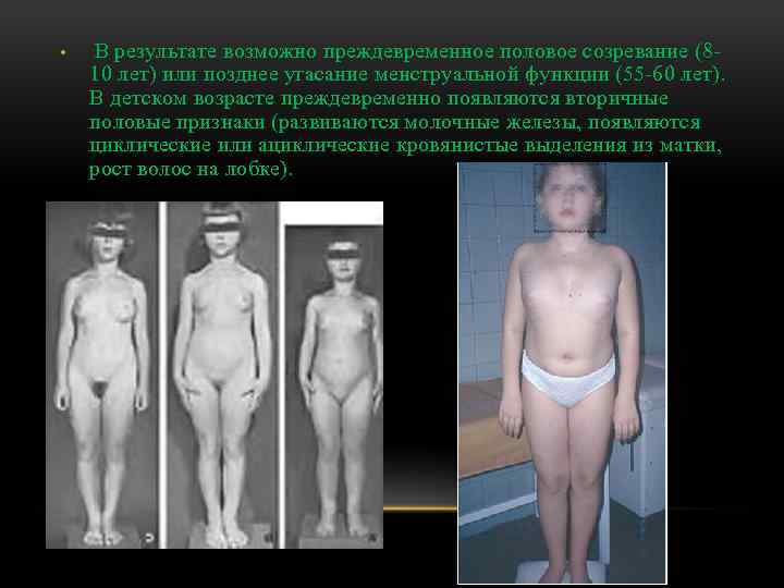  • В результате возможно преждевременное половое созревание (8 10 лет) или позднее угасание