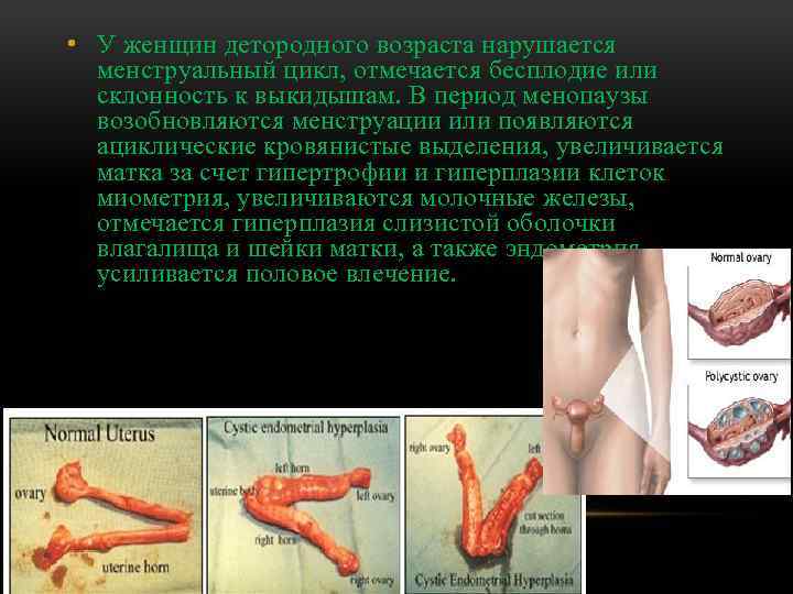  • У женщин детородного возраста нарушается менструальный цикл, отмечается бесплодие или склонность к