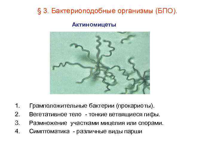 Три организма относящиеся к бактериям. Актиномицеты строение клеточное. Актиномицеты бактерии мицелий. Актиномицеты прокариоты. Строение клетки актиномицетов.