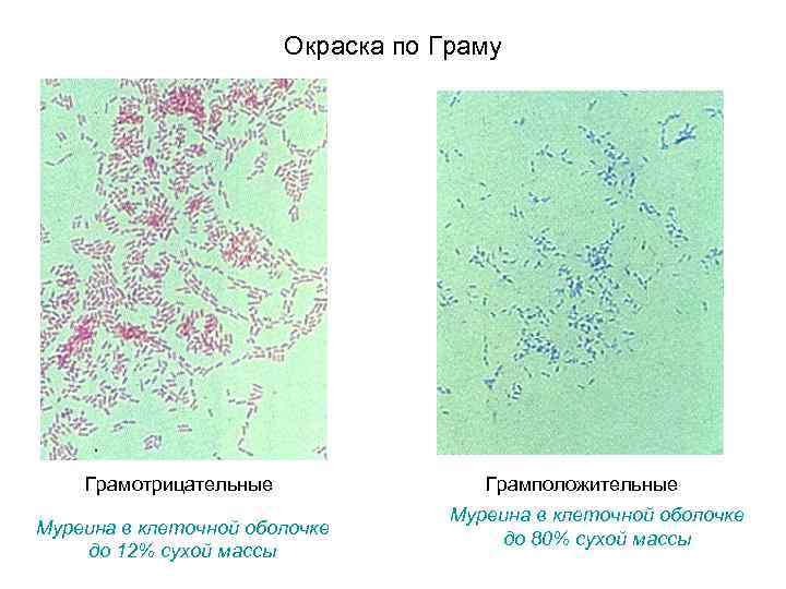 Окраска по граму. Окраска по Граму грамположительные и грамотрицательные. Грамположительные и грамотрицательные бактерии окраска. Грамотрицательные бактерии цвет. Грамположительные организмы.