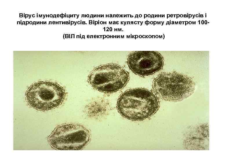 Вірус імунодефіциту людини належить до родини ретровірусів і підродини лентивірусів. Віріон має кулясту форму