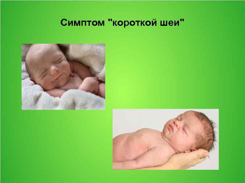 Родовые травмы картинки